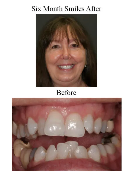 Tallahassee Cosmetic Dentistry