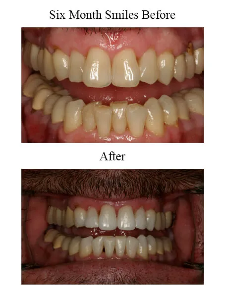 Tallahassee Cosmetic Dentistry