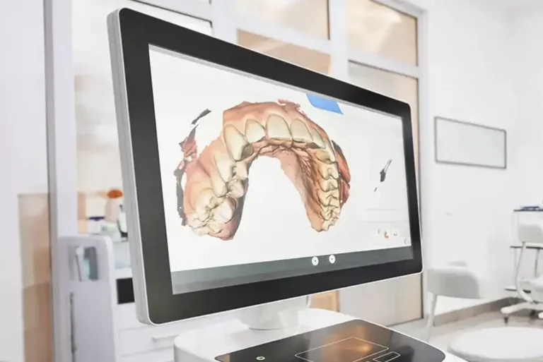 Digital scanner dental technology at Apalachee Bay Family Dental in Tallahassee, FL.