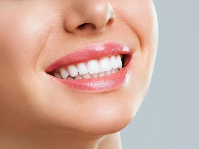 Smile Makeover